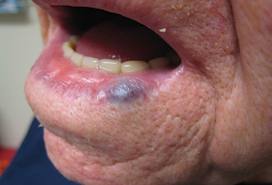 Buono significa per candeggiare di pelle di faccia